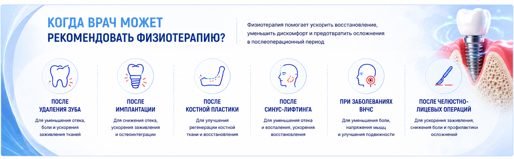 Когда назначают физиотерапию после имплантации