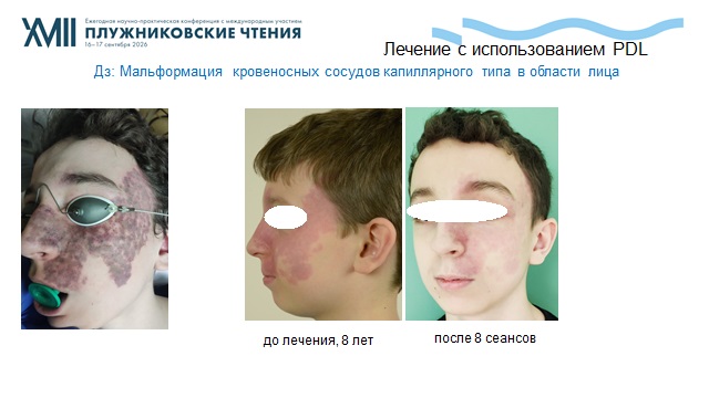 Слайд 6